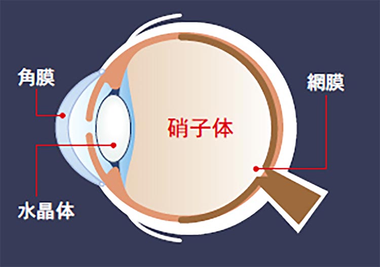 硝子体のイメージ画像